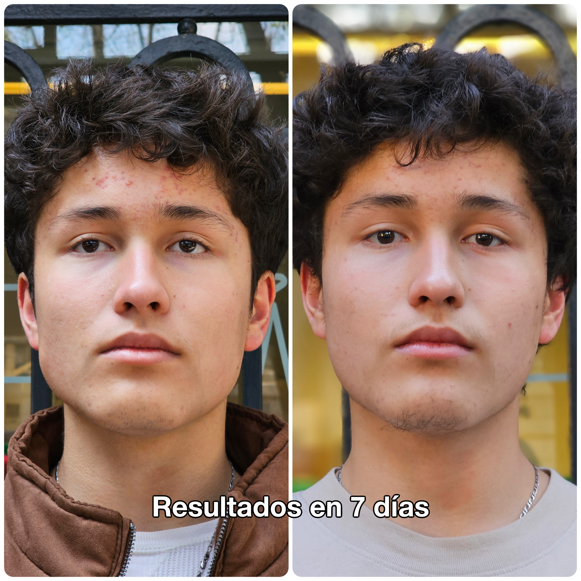 Kit Prueba 7 Días