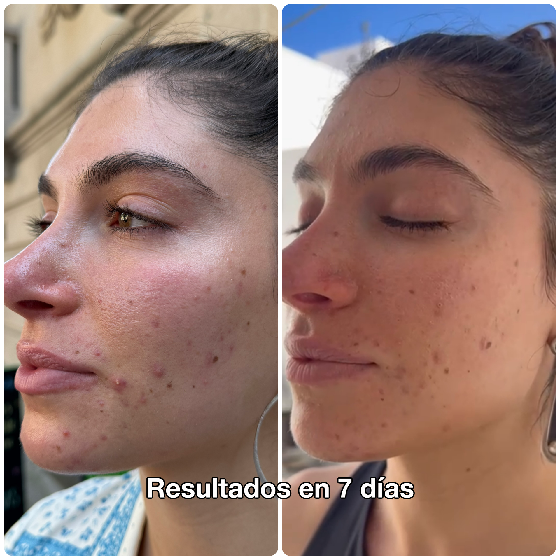 Kit Prueba 7 Días