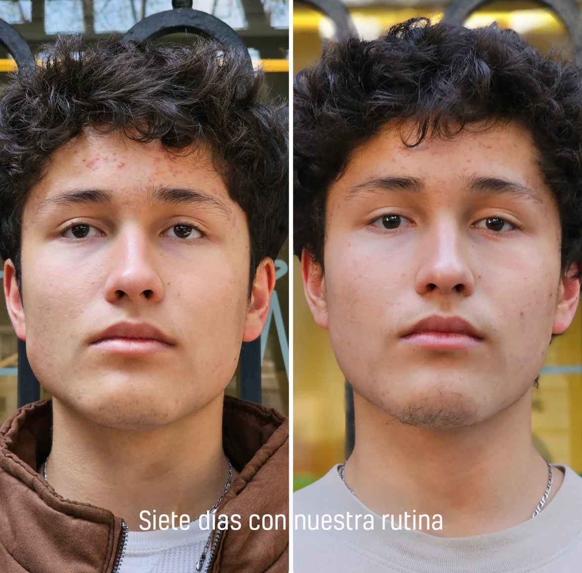 Kit Prueba 7 Días