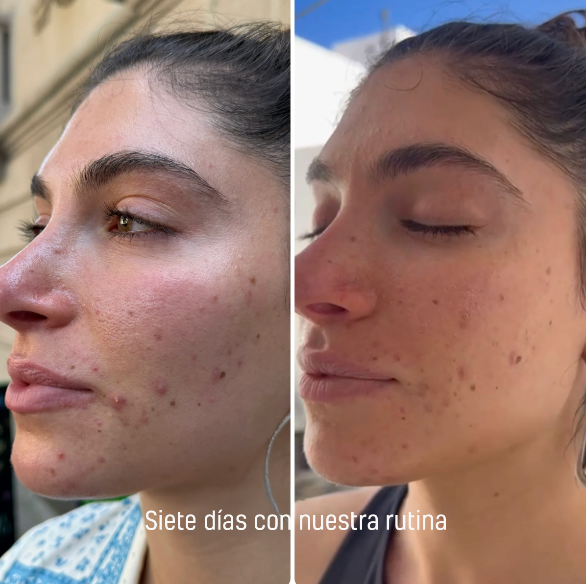 Kit Prueba 7 Días